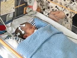UK Baby Is First To Be Given Cannabis-Derived Medicine In New Trial